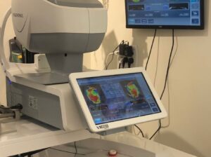 Visionix VX650 Multi-Modal Assessment System